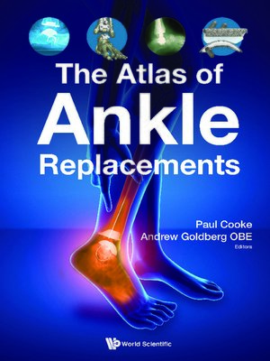 cover image of The Atlas of Ankle Replacements